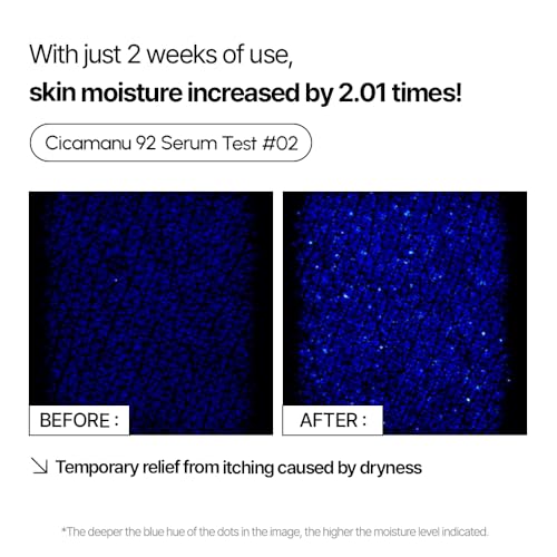 Parnell Cicamanu 92 Serum - Melatonin, Centella Asiatica, Ceramide and Overnight Recovery Moisturizing Ampoule for Hyperpigmentation and Soothing Irritated Skin (1.01 Fl Oz / 30ml)