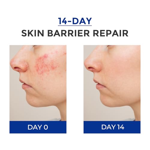 Intensive Repair Serum, 15% Hyaluronic Acid Serum with Ceramides and Centella Extract, Barrier Repair Redness Reilef Rosacea Treatment for Face Sensitive Acne Prone Skin, 30 Vials