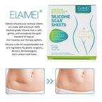 Medical Grade Silicone Scar Sheets, Silicone Scar Tape (1.6”x 60”), Scar Removal Strips for Acne Scars C-Section & Keloid Surgery Scars Sheets Treatment Sheets - 6-8 Month Supply