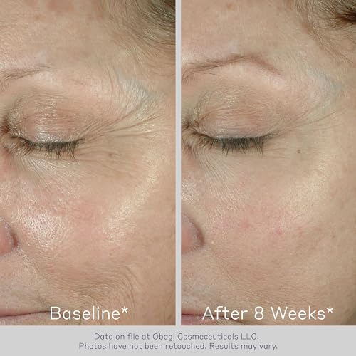 Obagi ELASTIderm Eye Cream – Lightweight, Smooth Formula Clinically Proven to Help Reduce the Appearance of Fine Lines & Wrinkles