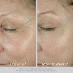 Obagi ELASTIderm Eye Cream – Lightweight, Smooth Formula Clinically Proven to Help Reduce the Appearance of Fine Lines & Wrinkles
