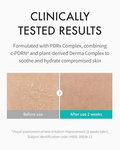REJURAN® Moisture Cream, c-PDRN® - Daily Moisturizer for Long-Lasting Hydration and Skin Barrier Support with PDRx. (2.11 oz)