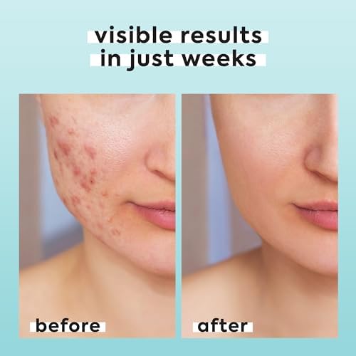 Hypochlorous Acid Spray for Face & Body, Helps Reduce Redness and Breakouts, Hypochlorous Spray, Multi-Purpose Topical Facial Skin Repair, pH-Balancing Toner, TSA Travel Size, Livaclean