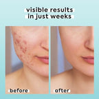 Hypochlorous Acid Spray for Face & Body, Helps Reduce Redness and Breakouts, Hypochlorous Spray, Multi-Purpose Topical Facial Skin Repair, pH-Balancing Toner, TSA Travel Size, Livaclean