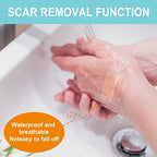 Silicone Scar Sheets (1.6” x 150”-3.8M), Medical Grade Soft Silicone Scar Tape, Strips, Roll - Keloid, C-Section, Surgical, Acne- Scars Removal Treatment, Painless Easy Removal, Reusable