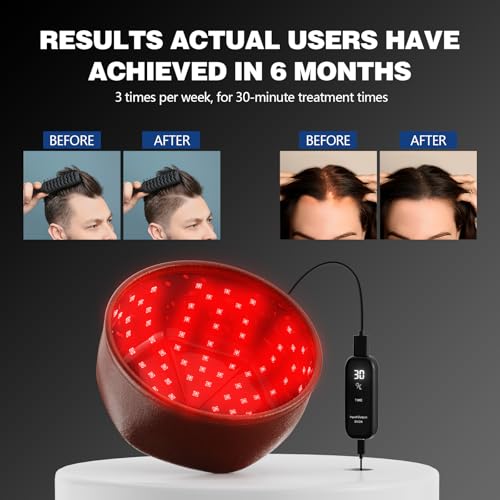 Laser Cap, Laser Red Light Therapy for Hair Growth System - FDA Cleared Hair Loss, Hair Thinning & Alopecia Treatment for Men & Women