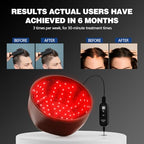 Laser Cap, Laser Red Light Therapy for Hair Growth System - FDA Cleared Hair Loss, Hair Thinning & Alopecia Treatment for Men & Women