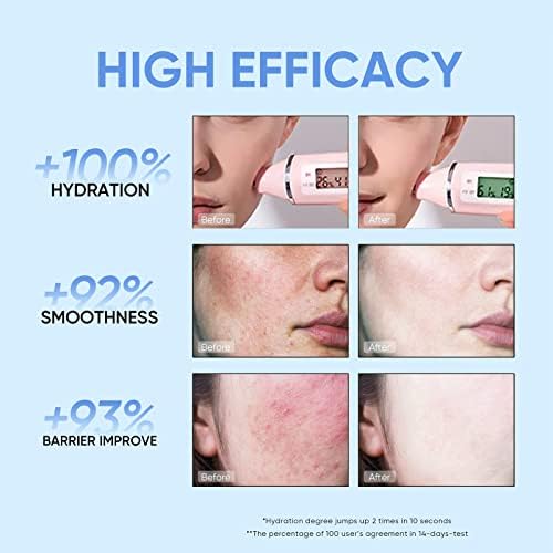 4D Hyaluronic Acid Barrier Essence Toner 100ml Facial Toner Hydrating Toner Non-Medicated Skin serum