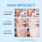 4D Hyaluronic Acid Barrier Essence Toner 100ml Facial Toner Hydrating Toner Non-Medicated Skin serum
