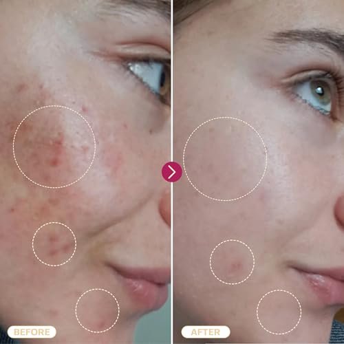 BASE LABORATORIES Hypochlorous Acid Spray for Face & Skin | 8oz | Magic Facial Spray Daily Skin Repair Solution for Sensitive Skin, Redness, Irritations, Eczema | Hypochlrous HOCL Molecule Spray | 2PK
