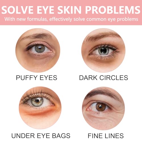 30 Pairs Lip Mask & Eye Mask,Under Eye Patches for Reducing Fine Lines & Dark Circles,Collagen Crystal Lip Patches for Lip Spa Daily Labial Masks Hydrating Lip Treatment Christmas Gifts