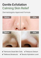 celimax Ji.Woo.Gae Heartleaf BHA Peeling Pad(60 Pads) + Dual Barrier Creamy Toner