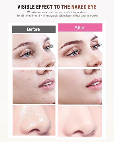 Red Light Therapy for Face, LED Face Mask Light Therapy,Near-Infrared 850 Red Light Therapy Mask(NIR),Portable,Rechargeable and Remote