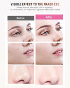 Red Light Therapy for Face, LED Face Mask Light Therapy,Near-Infrared 850 Red Light Therapy Mask(NIR),Portable,Rechargeable and Remote