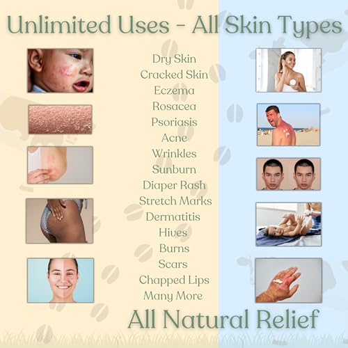 Beef Tallow for Skin | NAKED TALLOW BALM | 1 Ingredient - 100% Grass Fed Beef Tallow | Beef Tallow for Body & Face | Whipped & UNSCENTED for Sensititve Dry Skin, Babies, Eczema, Psoriasis, Rosacea (4oz)