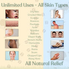 Beef Tallow for Skin | NAKED TALLOW BALM | 1 Ingredient - 100% Grass Fed Beef Tallow | Beef Tallow for Body & Face | Whipped & UNSCENTED for Sensititve Dry Skin, Babies, Eczema, Psoriasis, Rosacea (4oz)