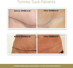Embrace Active Scar Defense for New Tummy Tuck Scars, FDA-Cleared Extra-Large Silicone Scar Sheets, 30 Day Supply