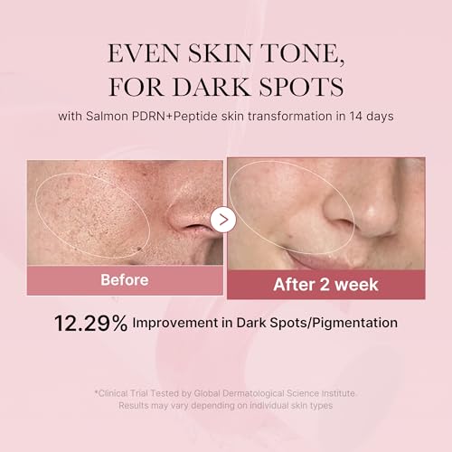 medicube Salmon DNA PDRN Pink Trio Set: Salmon DNA PDRN Pink Peptide Serum and Salmon DNA PDRN Pink CICA Soothing Toner and Salmon DNA PDRN pink collagen jelly gel mask (4ea)