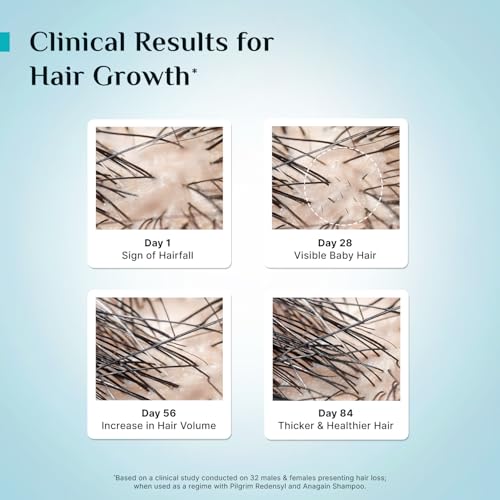 Pilgrim Advanced Hair Growth Serum | with 3% Redensyl + 4% Anagain | Stops Hair Loss & Hair Thinning | Hair Growth Treatment | Provides Thick & Dense Hair | 1.01 Fl Oz (30ml)