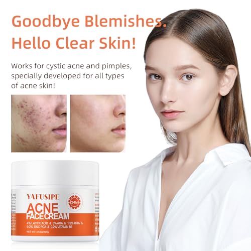 Acne Treatment for Face for Hormonal Cystic Stubborn Acne Cream for Sensitive Skin Teens Adults Women Men Spot Pimple Butt Control Rapid Clearing Breakout Overnight