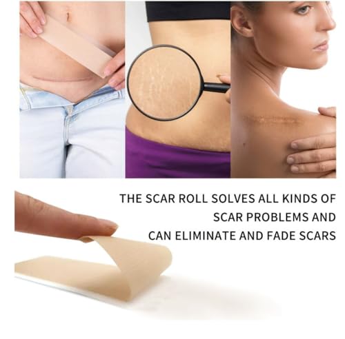 Losveo Silicone Scar Sheets For Face Wrinkles, 1.6”x 120”/3m Collagen Scar Tape Strips for Face,Medical Grade Silicone Scar Sheets for Surgical Scars,C-Section, Burn, Scars- Reusable(1box/3m)