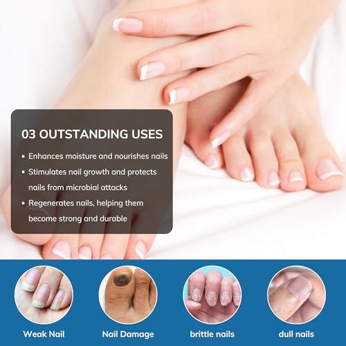 Abera Advanced Nail Repair Serum - Restorative Care for Brittle, Cracked & Discolored Nails - Supports Healthy Nails (Blue)