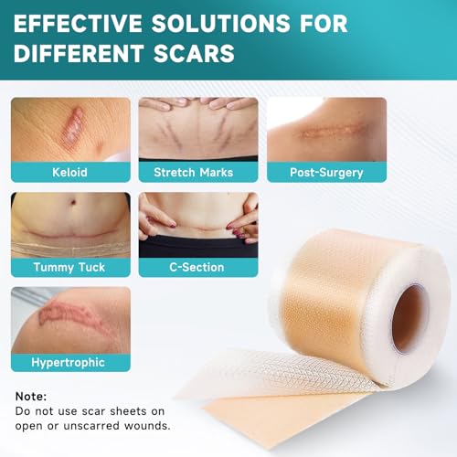Silicone Scar Sheets, Silicone Scar Tape Strips(1.6”x 60” Roll-1.5M), Professional Away Sheets for Surgical Scars, Keloid, C-Section, Burn et