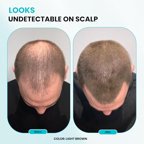 SURETHIK Hair Fibers, 15g (Black), Fills Thinning Hair for Visibly Fuller Look, Conceals Bald Spots, Natural Look, For Men & Women