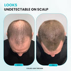 SURETHIK Hair Fibers, 15g (Black), Fills Thinning Hair for Visibly Fuller Look, Conceals Bald Spots, Natural Look, For Men & Women