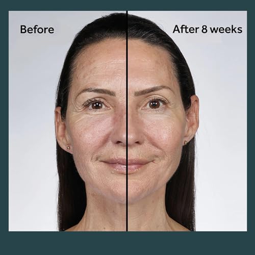 No7 Future Renew Damage Reversal Night Cream - Anti Aging Face Moisturizer - Infused with Peptide Technology to Reverse Visible Signs of Damage - Skin Barrier Repair for Dry Skin (1.69 Oz)