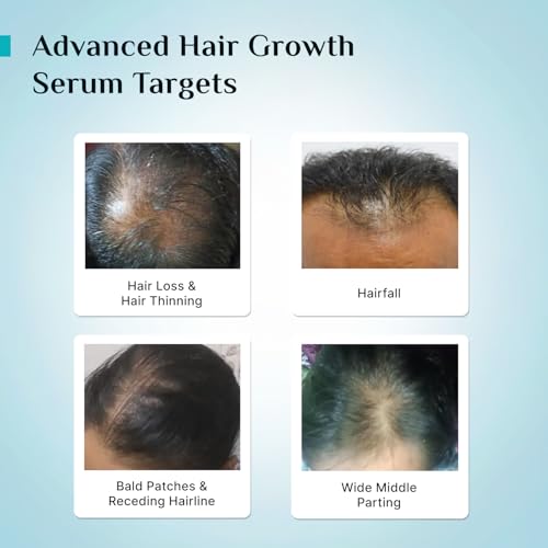 Pilgrim Advanced Hair Growth Serum | with 3% Redensyl + 4% Anagain | Stops Hair Loss & Hair Thinning | Hair Growth Treatment | Provides Thick & Dense Hair | 1.01 Fl Oz (30ml)