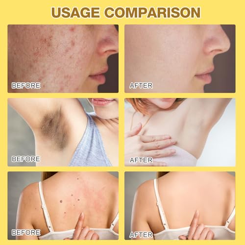 Bee Venom Cream, 2024 New Professional Bee Venom Moisturizing Cream,Bee Venom Moisturizing Gel, Natural Bee Venom Repair Cream, for All Skin Types (2pcs)