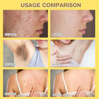 Bee Venom Cream, 2024 New Professional Bee Venom Moisturizing Cream,Bee Venom Moisturizing Gel, Natural Bee Venom Repair Cream, for All Skin Types (2pcs)