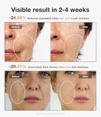 JOVS 4D Laser Light Therapy Mask, Red Light Therapy for Face with 4 Different Wavelength Adopted FPT Concentrated Technology, 3 Modes Portable Face Mask for Anti-aging