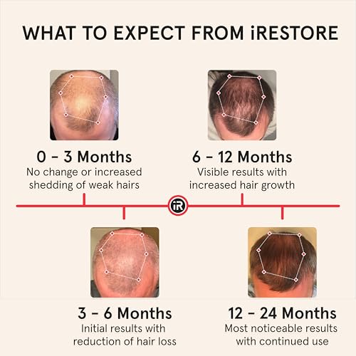 iRestore Professional + Rechargeable Battery Pack - Laser Red Light Therapy for Hair Growth - FDA Cleared Hair Loss, Thinning Treatment for Men & Women - Hair Regrowth Cap - 282 Lasers & LEDs