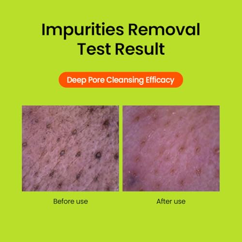 beplain Mung Bean pH-Balanced Cleansing Foam | Scent-free Cleanser | Gentle & Moisturizing Face Wash for All Skin Types | Makeup Remover | Korean Skin Care (2.7fl.oz)