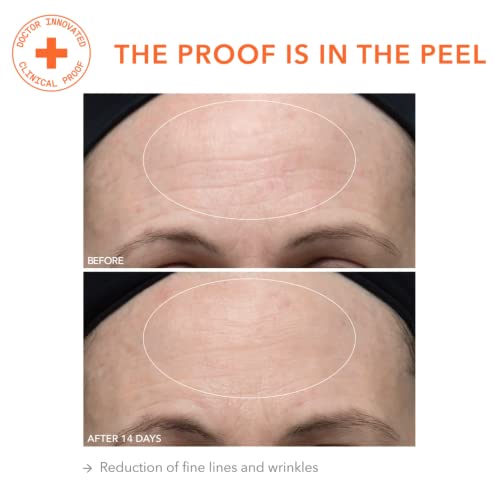 Dr. Dennis Gross Alpha Beta Ultra Gentle Daily Peel: for Dehydrated or Sensitive Skin, Uneven Tone or Texture, Fine Lines or Enlarged Pores (30 Treatments)