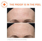 Dr. Dennis Gross Alpha Beta Ultra Gentle Daily Peel: for Dehydrated or Sensitive Skin, Uneven Tone or Texture, Fine Lines or Enlarged Pores (30 Treatments)