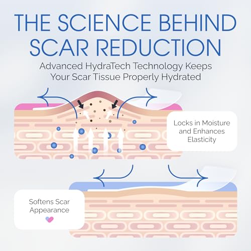 C Section Scar Silicone Strips for Surgical Scars, Tummy Tuck, C Section Recovery Must Haves - Silicone Scar Sheets - Large 7 inch, 8 Reusable Strips