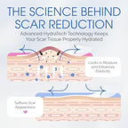 C Section Scar Silicone Strips for Surgical Scars, Tummy Tuck, C Section Recovery Must Haves - Silicone Scar Sheets - Large 7 inch, 8 Reusable Strips