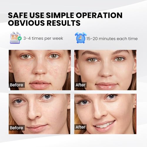 Yahi Red Light Therapy Mask for Face, 7-1 Colors LED Facial Skin Care Mask, Led Face Mask Light Therapy