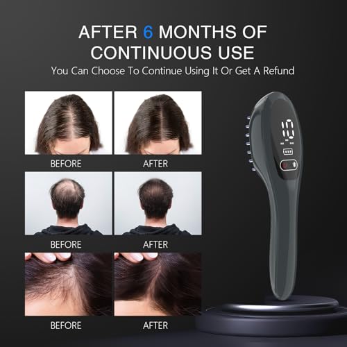 Laser Therapy Hair Growth Comb, Red Light Therapy for Hair Growth, FDA Cleared Laser Comb System, Hair Loss, Hair Thinning & Alopecia Treatment for Men & Women Homeuse