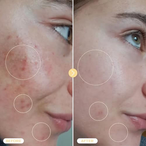 BASE LABORATORIES Hypochlorous Acid Spray for Face & Skin - Travel Size - Magic Facial Toner Spray & Cleaner - Skin Repair Solution helps reduce redness, acne - HOCL Molecule Spray 4oz (2 x 2oz) - 2PK
