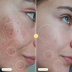 BASE LABORATORIES Hypochlorous Acid Spray for Face & Skin - Travel Size - Magic Facial Toner Spray & Cleaner - Skin Repair Solution helps reduce redness, acne - HOCL Molecule Spray 4oz (2 x 2oz) - 2PK