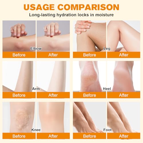 Beef Tallow for Skin, Moisturizer Cream, Nourishing and Hydrating Skin, Organic Beef Tallow & Honey Balm for Skin,Natural Grass-Fed Beef Tallow Cream with Raw Honey for All Skin Care (1 PCS,60g)