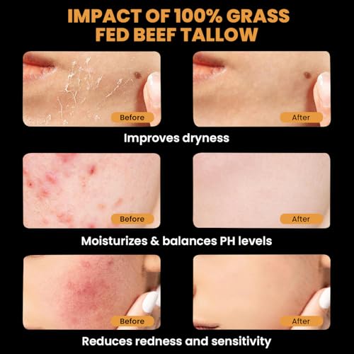 MONIER Tallow and Honey Balm for Face, Beef Tallow for Skin, Moisturizer with 100% Organic Grass-Fed Beef Tallow & Raw Wild Honey - Natural Formula for Dry & Sensitive Skin (Unscented)
