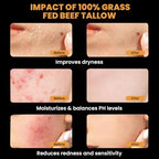 MONIER Tallow and Honey Balm for Face, Beef Tallow for Skin, Moisturizer with 100% Organic Grass-Fed Beef Tallow & Raw Wild Honey - Natural Formula for Dry & Sensitive Skin (Unscented)