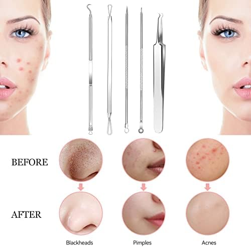Blackhead Remover Set 8 Pcs Stainless Steel Whitehead Blemish Removal Tool with Portable Metal Case