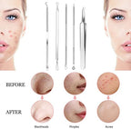 Blackhead Remover Set 8 Pcs Stainless Steel Whitehead Blemish Removal Tool with Portable Metal Case