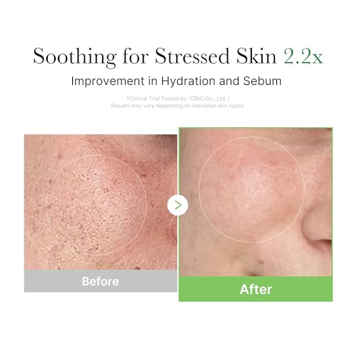 medicube Exosome Cica Tea Tree Cream for Sensitive Skin with Centella Asiatica help reduce redness and breakouts. | Low-irritating, Moisturizing Daily Texture Care | Korean Skincare | 1.7 fl oz